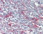 CD209 / DC-SIGN Antibody (Internal)